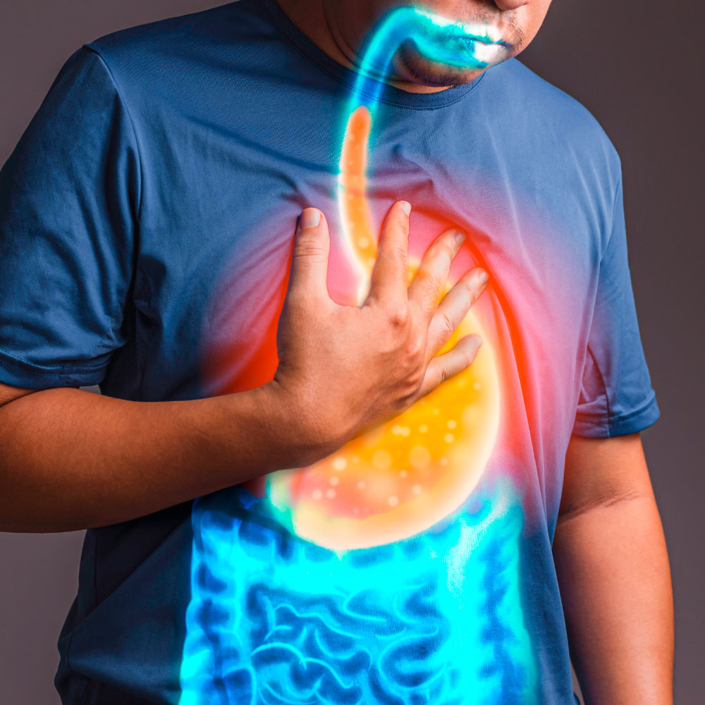Homem com a mão no peito, ilustrando refluxo gástrico com efeitos visuais do sistema digestivo em destaque na camisa.