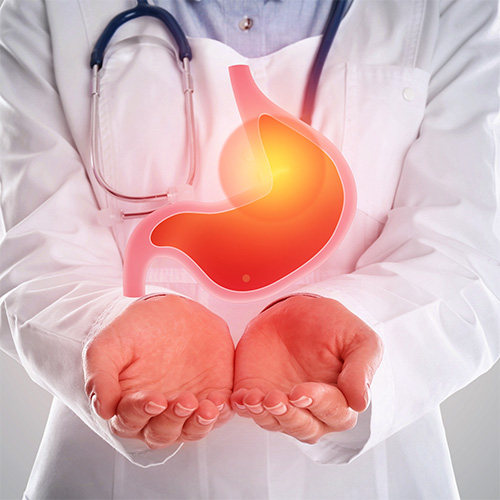 Médico com estetoscópio segurando ilustração de estômago em vermelho e amarelo, simbolizando refluxo ou doença gastrointestinal.