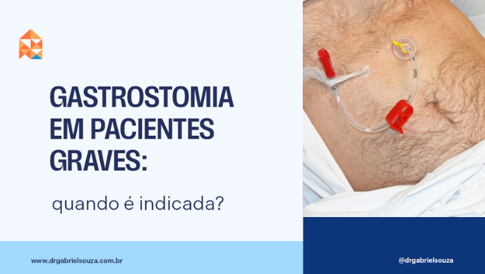 Gastrostomia em pacientes graves: quando é indicada? 1 Paciente em ambiente hospitalar com sonda de gastrostomia abdominal, utilizada para alimentação direta ao estômago.