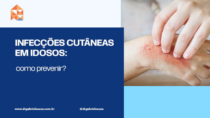 Infecções cutâneas em pessoas idosas: como prevenir? 1 Mão com área avermelhada e irritada sendo coçada, sugerindo inflamação ou possível infecção cutânea.
