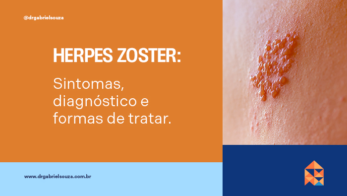 Lesão cutânea com pequenas bolhas agrupadas sobre pele avermelhada, característica de herpes-zóster.