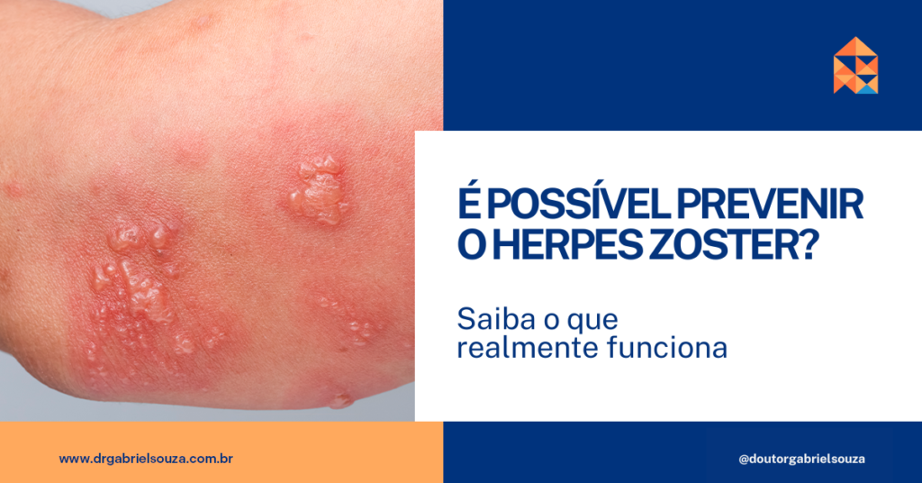 Pele com lesões avermelhadas e bolhas agrupadas, características de irritação ou infecção cutânea.